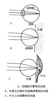 ����γ�ԭ��ʾ��ͼ