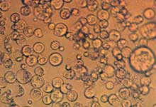 ϸ����ֳ�ķ���